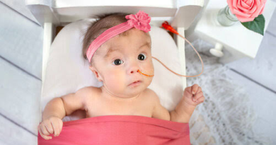 Edwards disease
